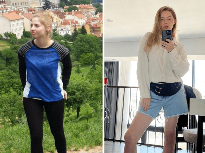 Anna Besel keto success story before and after